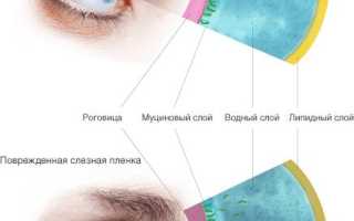 Синдром сухого глаза обеих глаз