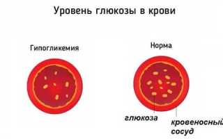 Код мкб фосфат диабет