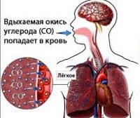 Отравление угарным газом