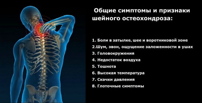 Поясничный остеохондроз с корешковым синдромом лечение