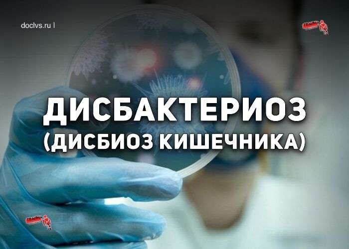 Дисбактериоз (дисбиоз кишечника): что это, в чем причины, какие симптомы, диагностика, можно ли вылечить и как?