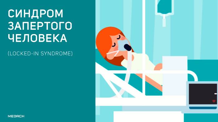 Что такое синдром запертого человека