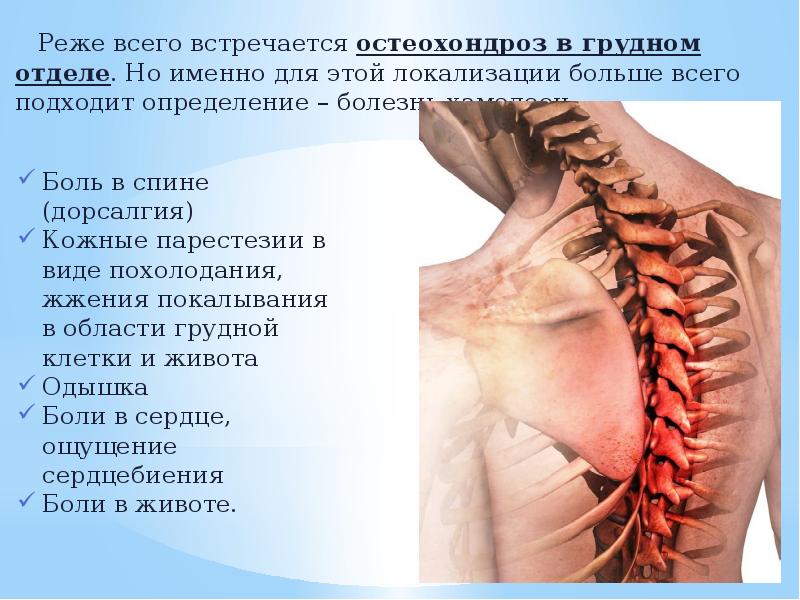 Поясничный остеохондроз с корешковым синдромом лечение