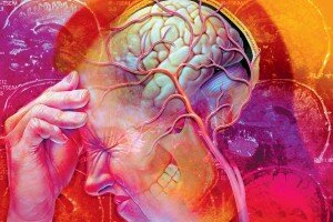 Синдром головная боль дифференциальная диагностика