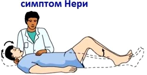 Поясничный остеохондроз с корешковым синдромом лечение