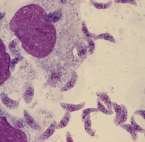 Toxoplasma gondii в мазке