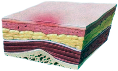 Первая степень пролежней. Стерильно.com