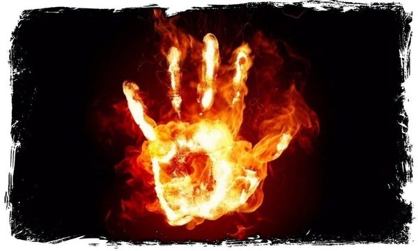 Íåáîëüøàÿ ïàìÿòêà ïî îæîãàì (îïðåäåëåíèå ãëóáèíû, ïëîùàäè è ïåðâàÿ ïîìîùü) Îæîã, Ìåäèöèíà, Ïàìÿòêà, Ïåðâàÿ ïîìîùü, Êîìáóñòèîëîã, Äëèííîïîñò