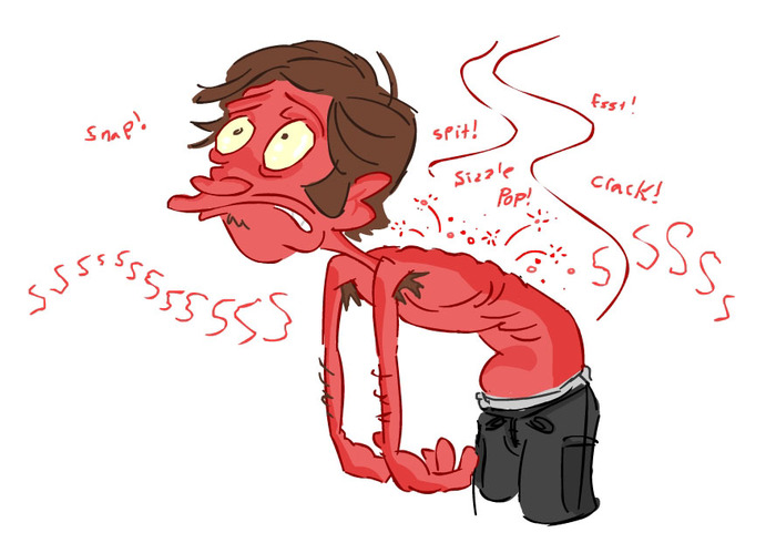 Íåáîëüøàÿ ïàìÿòêà ïî îæîãàì (îïðåäåëåíèå ãëóáèíû, ïëîùàäè è ïåðâàÿ ïîìîùü) Îæîã, Ìåäèöèíà, Ïàìÿòêà, Ïåðâàÿ ïîìîùü, Êîìáóñòèîëîã, Äëèííîïîñò