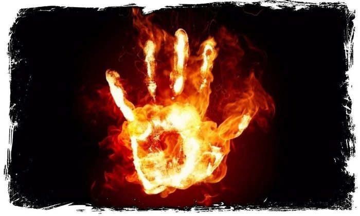 Âîçâðàùåíèå âðà÷à êîìáóñòèîëîãà Êîìáóñòèîëîã, Îæîã, Ìåäèöèíà, Äëèííîïîñò