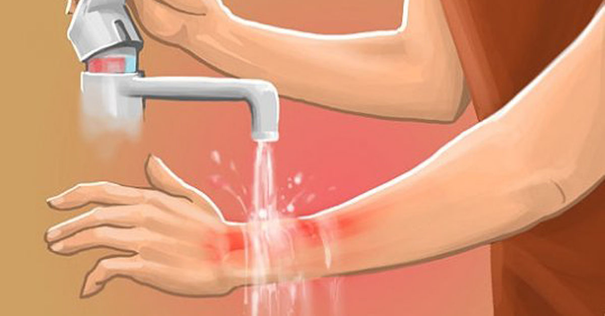 Жалобы больного с ожогами кожи