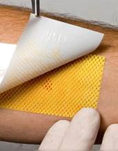 Жалобы больного с ожогами кожи