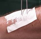 Жалобы больного с ожогами кожи