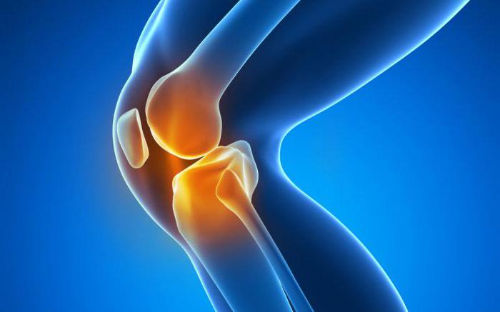 воспаление суставов