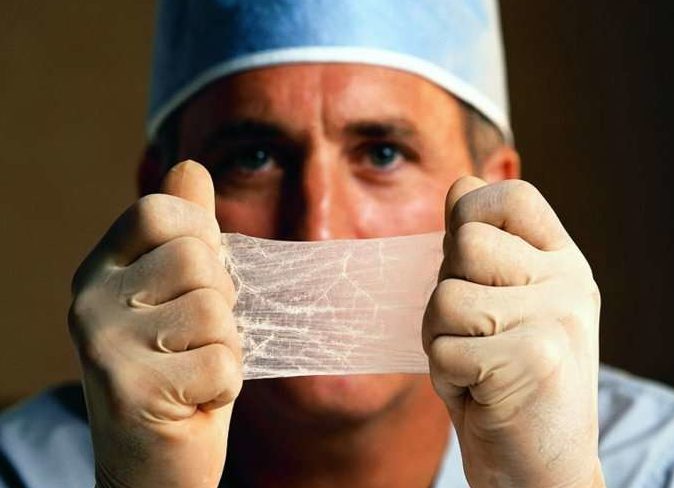 пересадка кожи после ожога