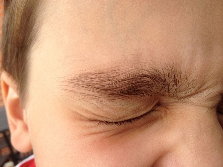 Первая помощь при химических ожогах негашеной известью