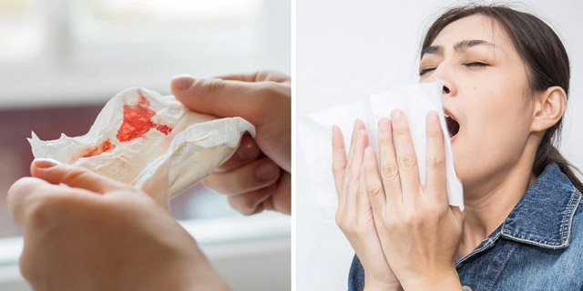 Пневмония мокрота с прожилками крови