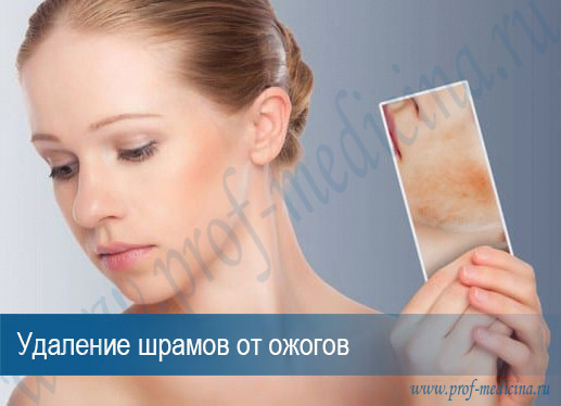 Удаление шрама после ожога цена