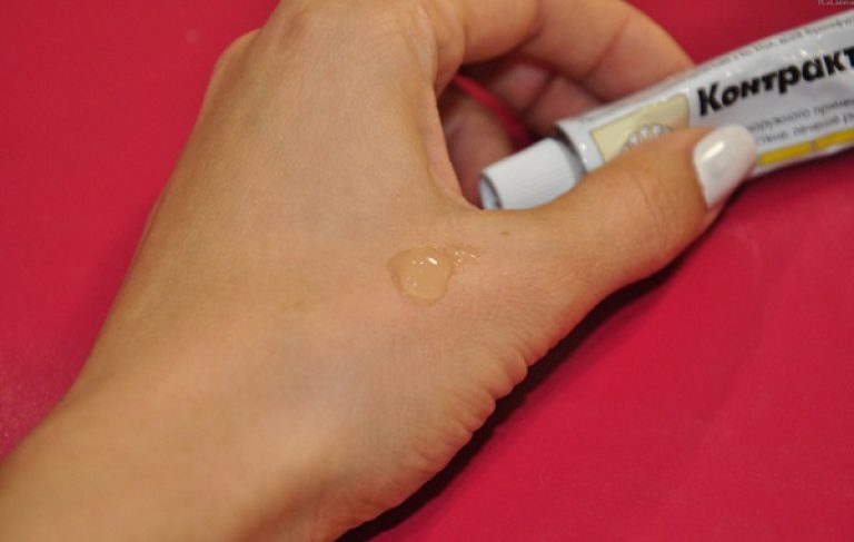 Удаление шрама после ожога цена