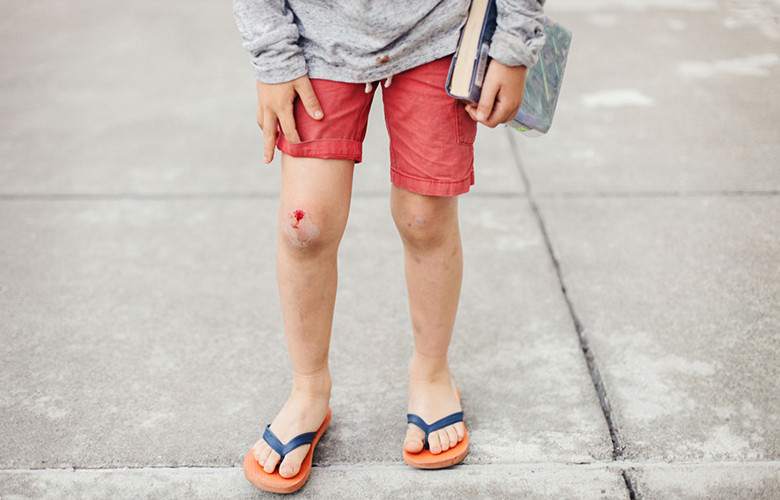 Ожоги от насекомых у детей