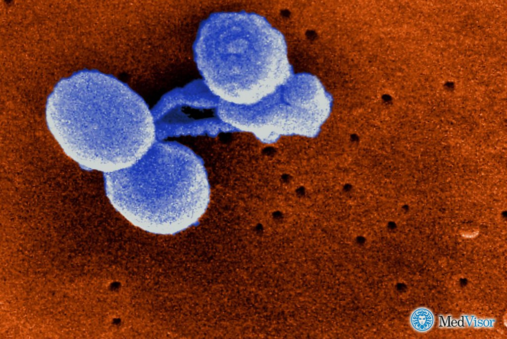 Бактериальная пневмония Лечение пневмонии без температуры у взрослых