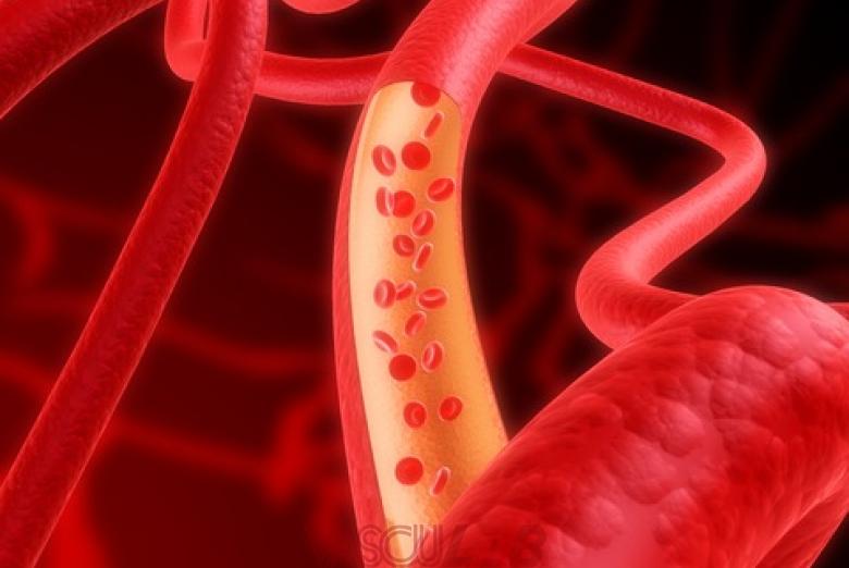 Улучшение кровообращения при подагре Улучшение кровообращения при подагре