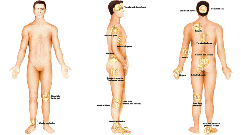 Все о пролежнях. Стерильно.com