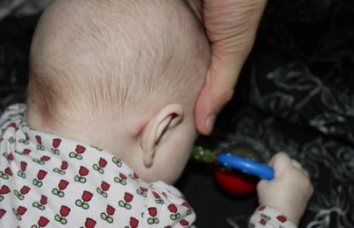 Волдыри на руках у ребенка похожие на ожог Волдыри на руках у ребенка похожие на ожог thumbnail