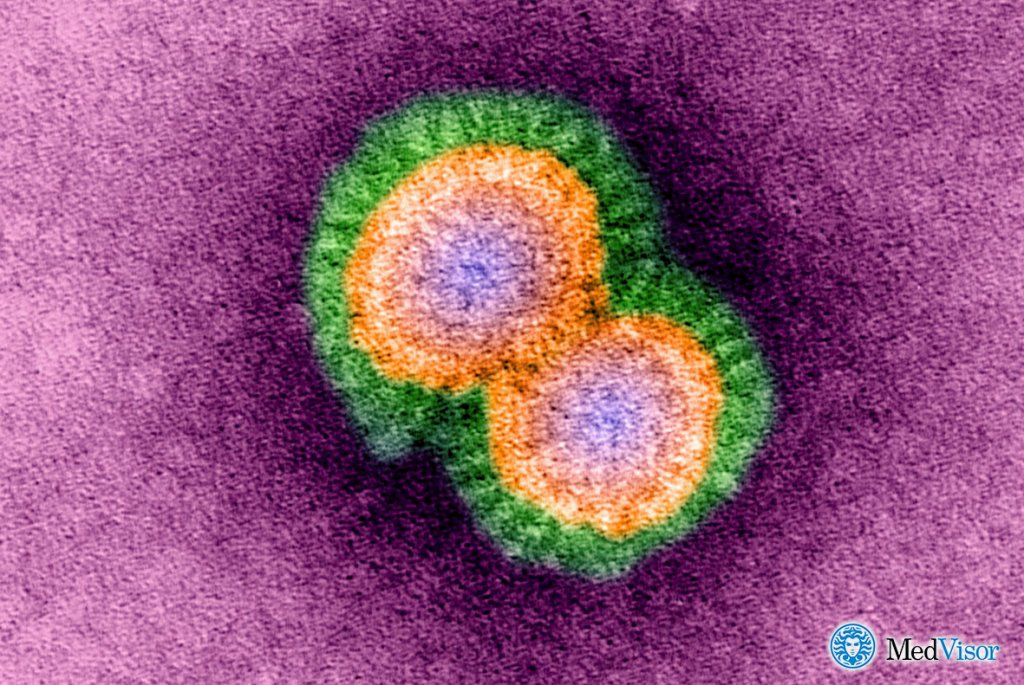 Вирусная пневмония Лечение пневмонии без температуры у взрослых