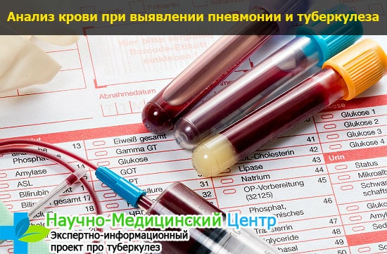 Можно ли заболеть туберкулезом из за пневмонии