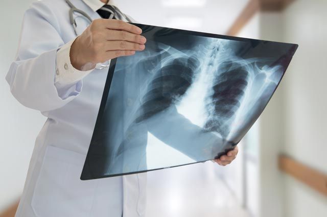 Можно ли работать с пневмонией