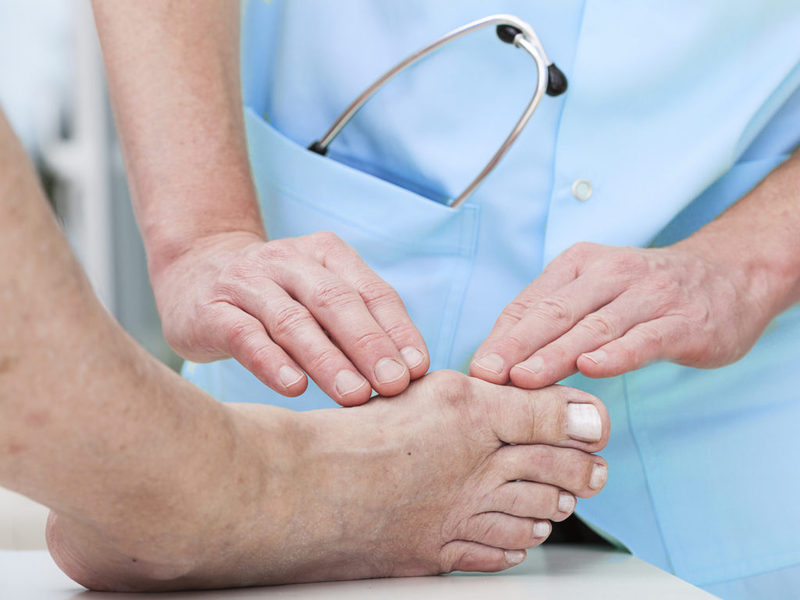 Подагра: простые упражнения для стопы Подагра: простые упражнения для стопы