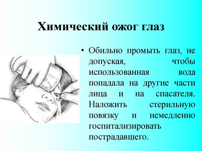 химический ожог роговицы