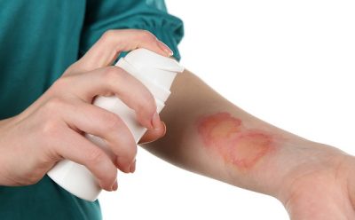 Как быстро убрать пузырь от ожога