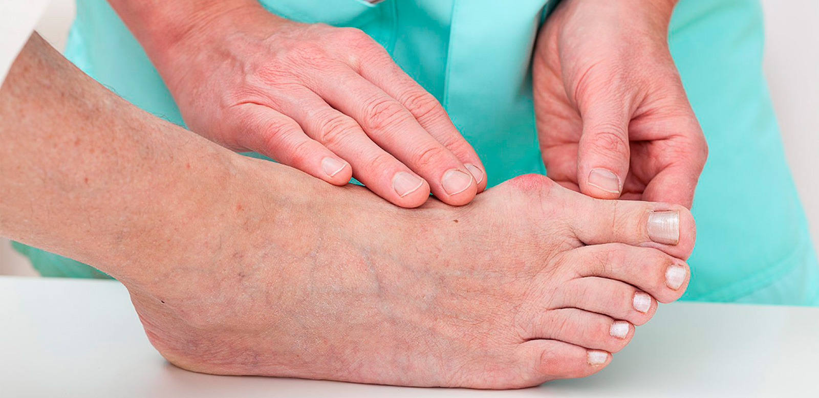 lokalizaciya-podkozhnyh-shishek Диета при подагре