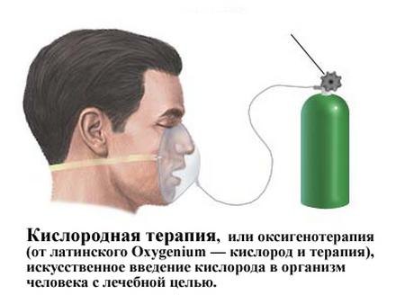 Оксигенотерапия Оксигенотерапия