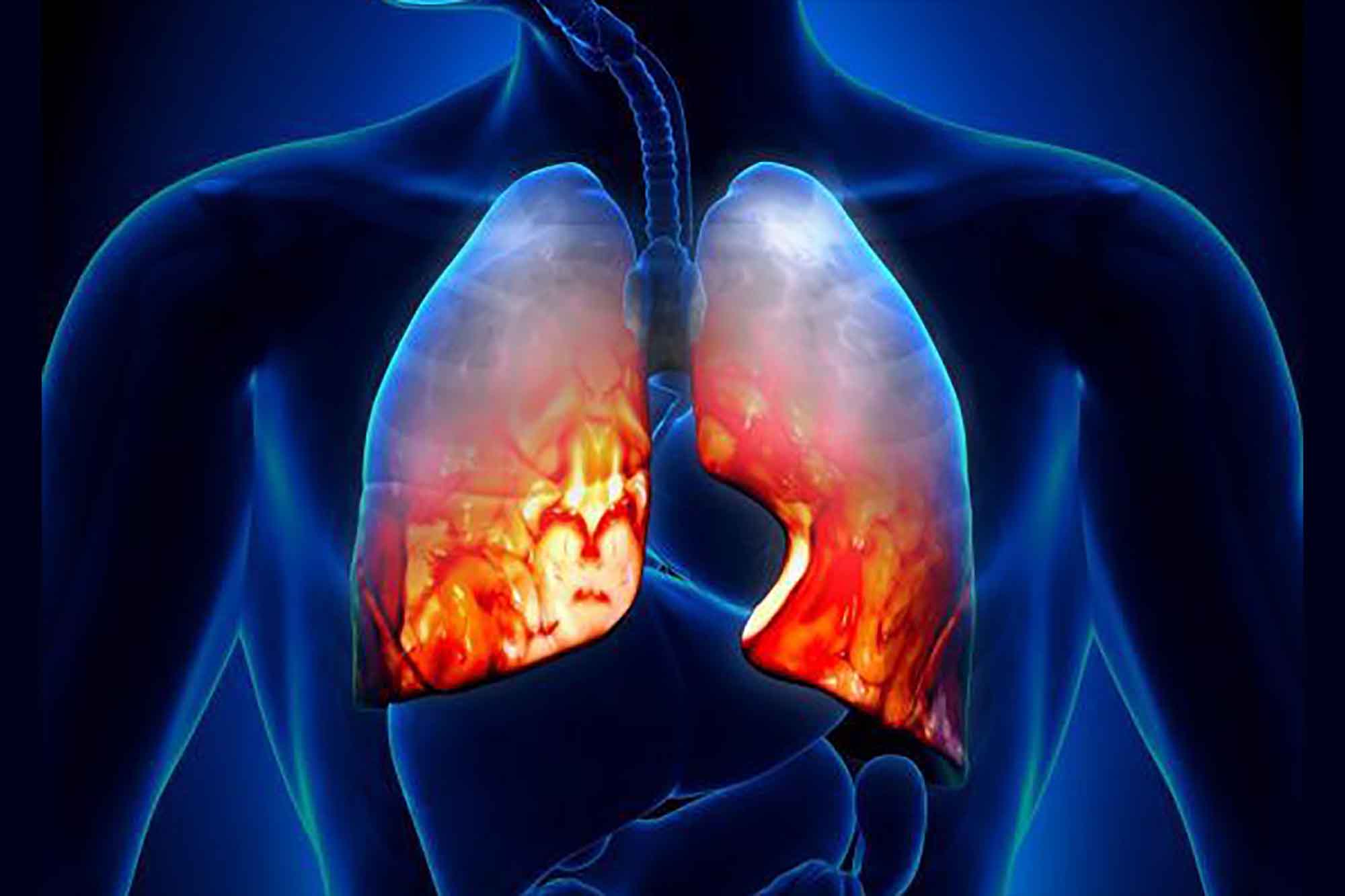 Осложнения с летальным исходом