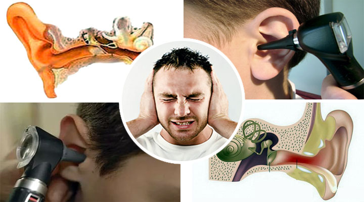 Локализация катарального процесса Локализация воспаления