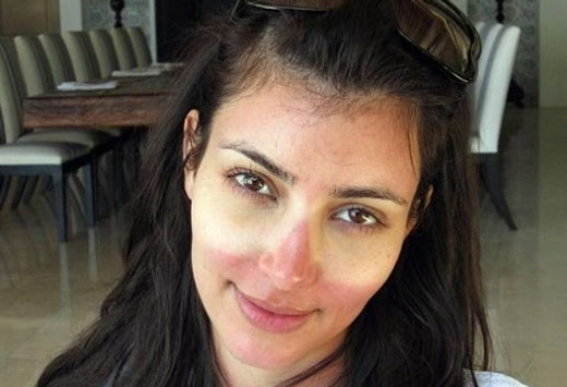 последствие лучевого ожога