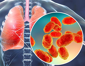 Основные последствия пневмонии для человека