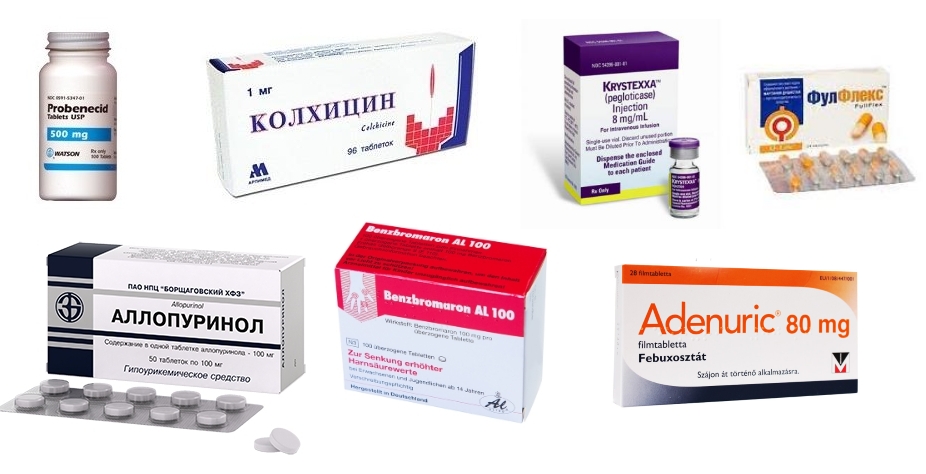 Чем снять боль и отеки при подагре Чем снять боль и отеки при подагре thumbnail