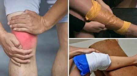 Компрессы Подагра: острая боль