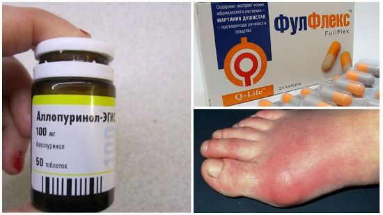 Аллопуринол, ФулФлекс