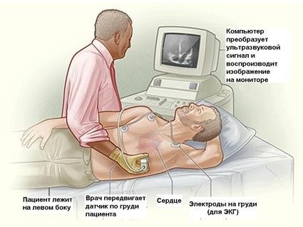 Проведение эхокардиографии Проведение эхокардиографии