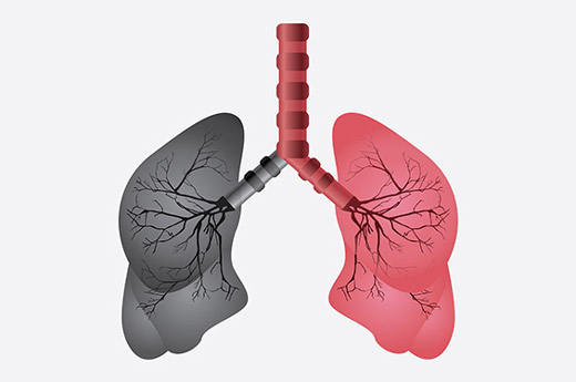 схема легких