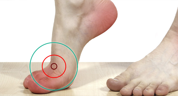 Симптомы болезни Симптомы болезни