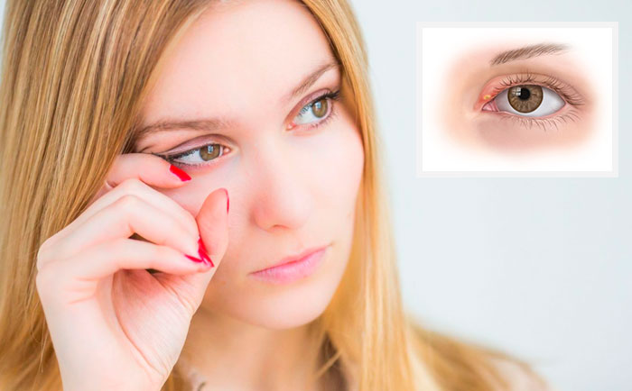 Глазные капли Тауфон – для чего назначают