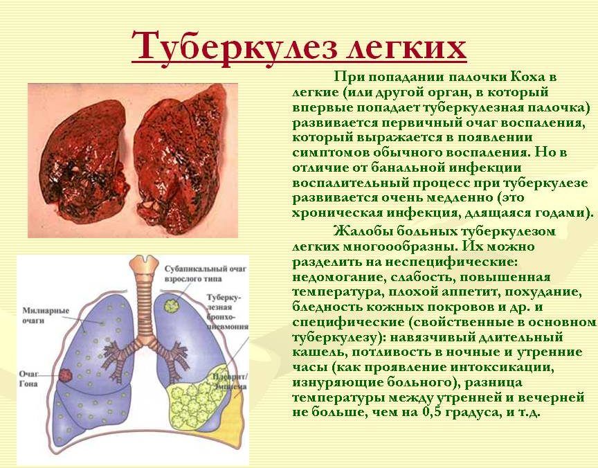 Формирование рубцовой ткани на поверхности легких вызвана туберкулезом