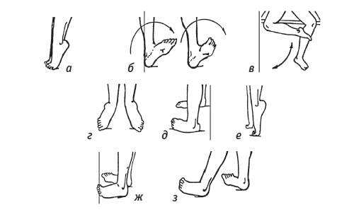Упражнения для стоп при подагре Упражнения для стоп при подагре